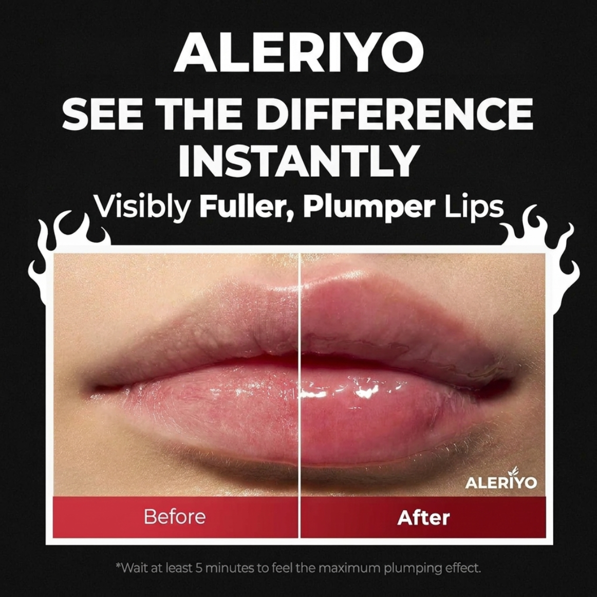 Aleriyo's™ Spicy Lip Plumper